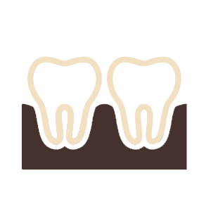 Протезирование зубов